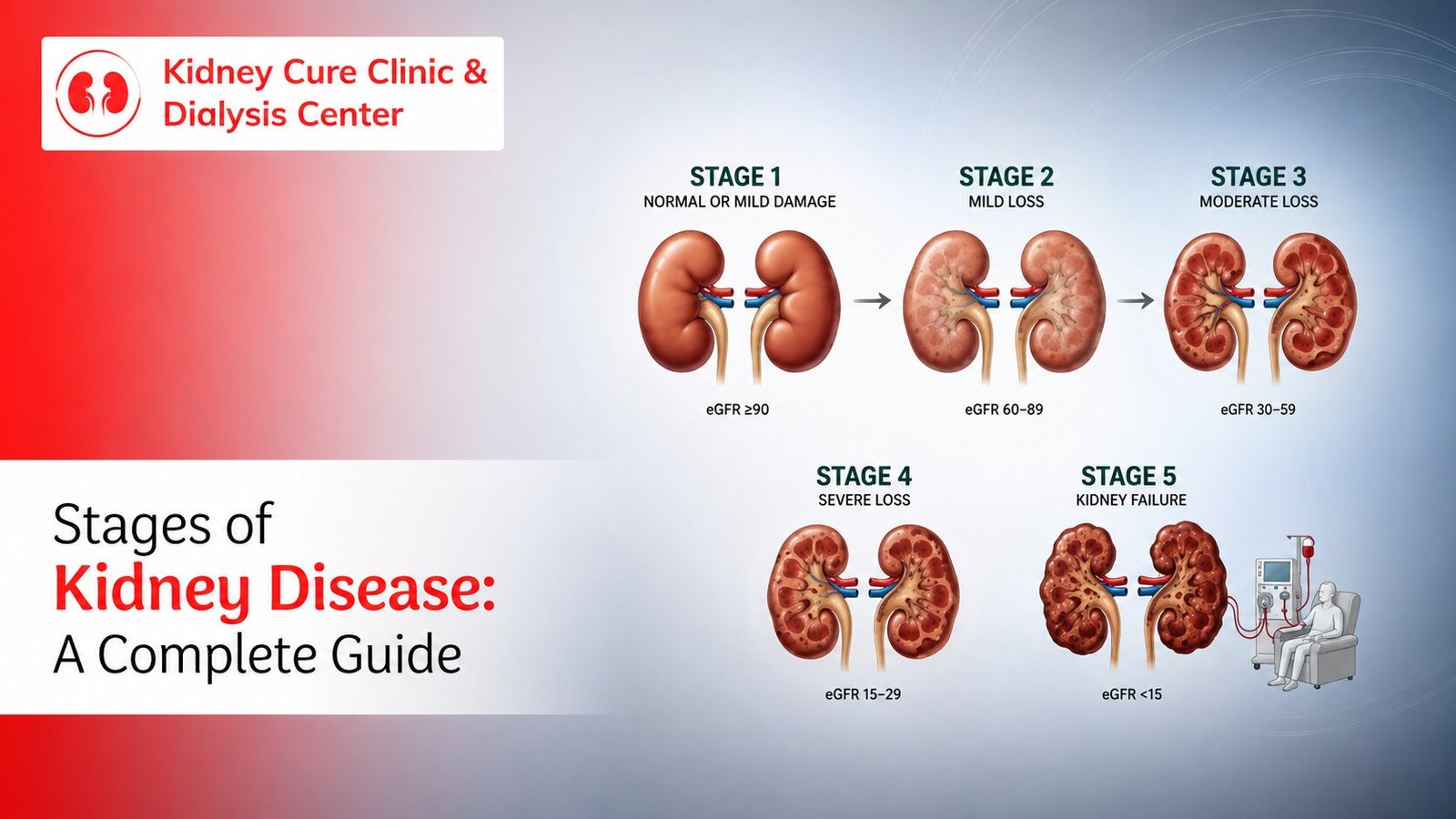 Stages of Kidney Disease: Symptoms, Causes & Treatment Guide